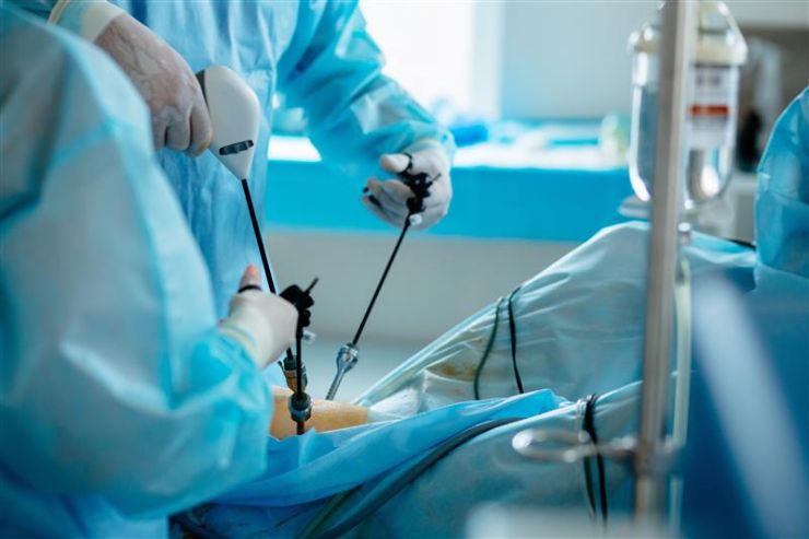 laparoscopic surgery